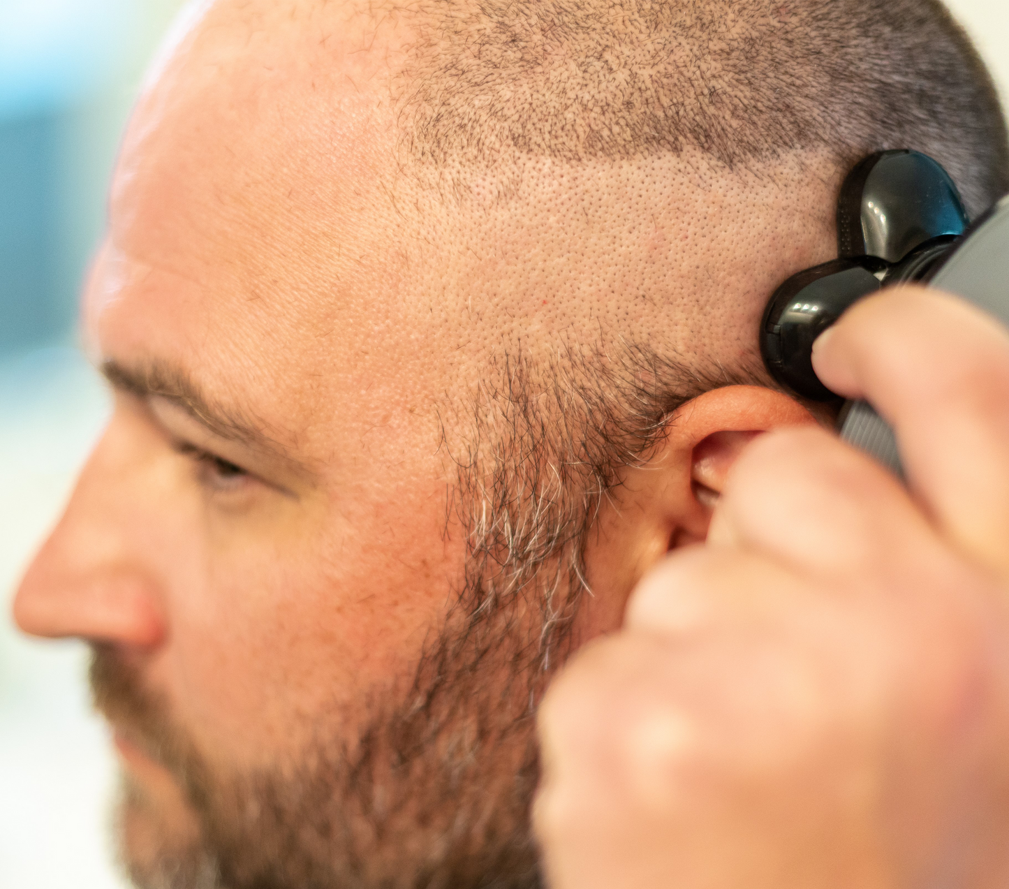 Shave Master Kit: Revolutionizing Bald Grooming For Men